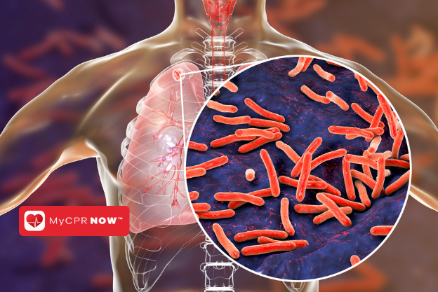 A diagram of a human chest with the right lung and spine visible, and a magnified spot of the lung.  