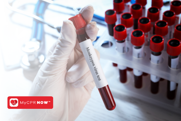 Dry Lab Pathogen Bloodborne Pathogens and Their Impact on the Medical Laboratory