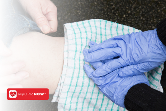 Pressure Points for Bleeding: A Lifesaving Guide