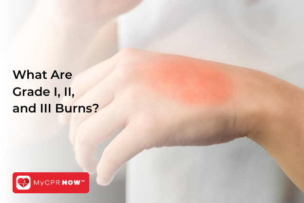 What Are Grade I, II, and III Burns?