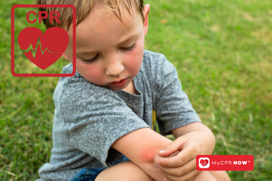 Don't Let Bugs Bug Your Kids: Pediatric First Aid Tips for Insect Bites and Stings from MyCPR Now