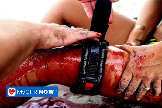 A leg that has a major wound with a lot blood on the leg and a tourniquet is positioned above the knee